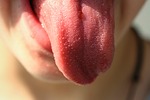 口臭は毒ガスなのか！？舌苔が原因の口臭は人体に有害との研究と舌苔を減らす方法。